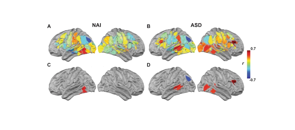Mapping neural correlates of biological motion perception in autistic children 