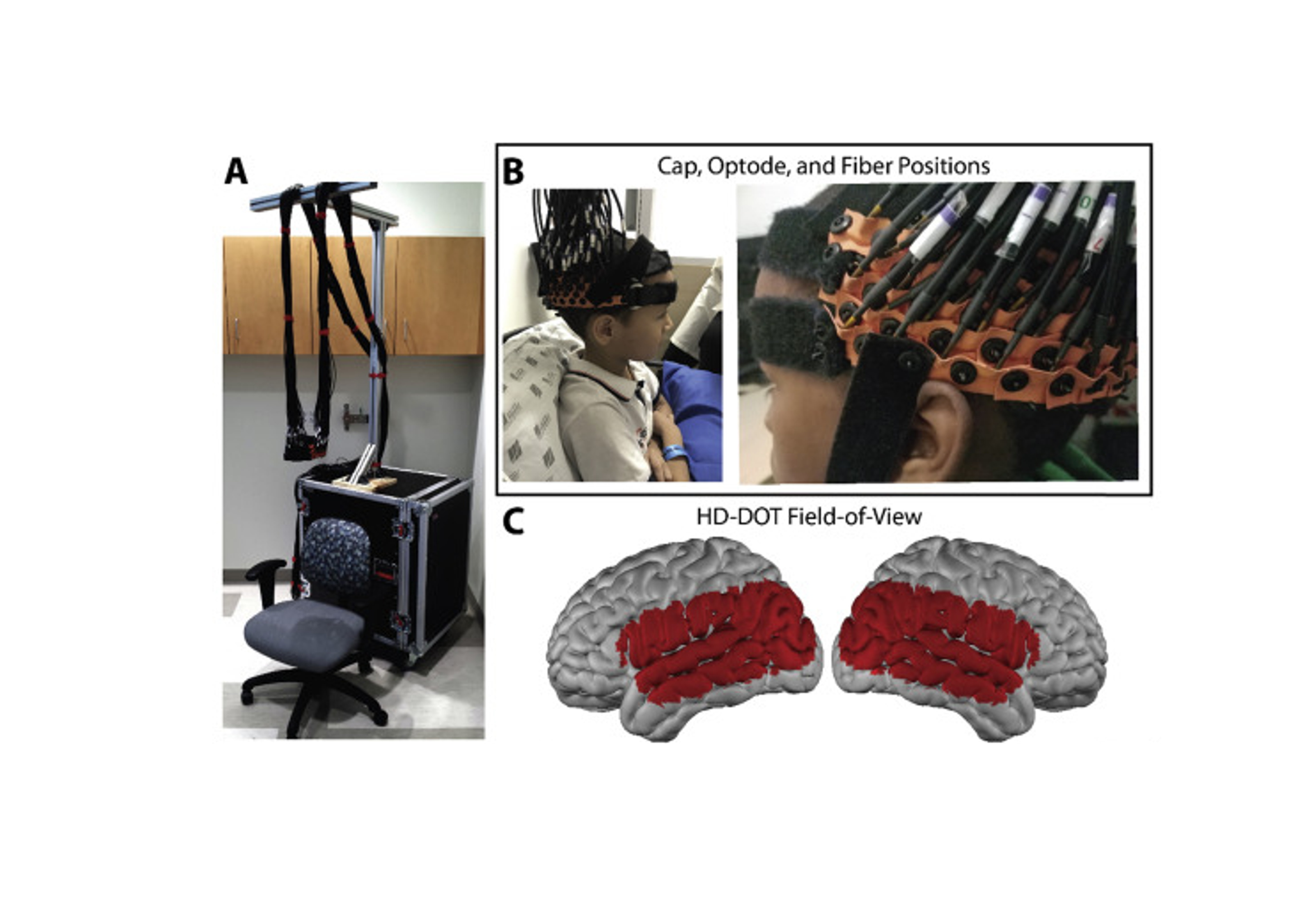 Portable, field-based neuroimaging