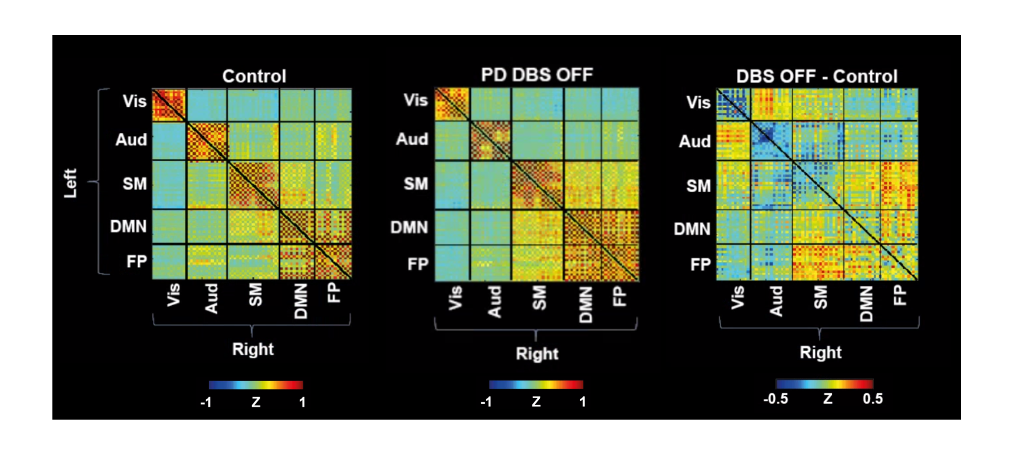 Mapping deep brain stimulation's impact on cortical networks